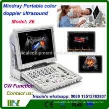 Z6 Mindray billigste CW-Funktion Farbe Doppler Ultraschall Maschine / Laptop Farbe Doppler Ultraschall